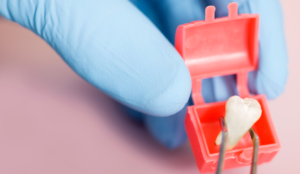 стоматология удаление зуба стоимость